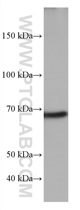WB analysis of MCF-7 using 66990-1-Ig (same clone as 66990-1-PBS)