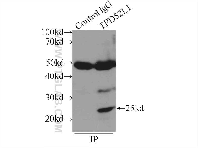 IP experiment of MCF-7 using 14732-1-AP