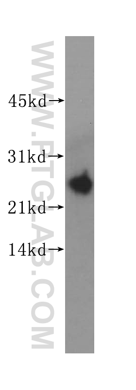 WB analysis of MCF-7 using 14732-1-AP