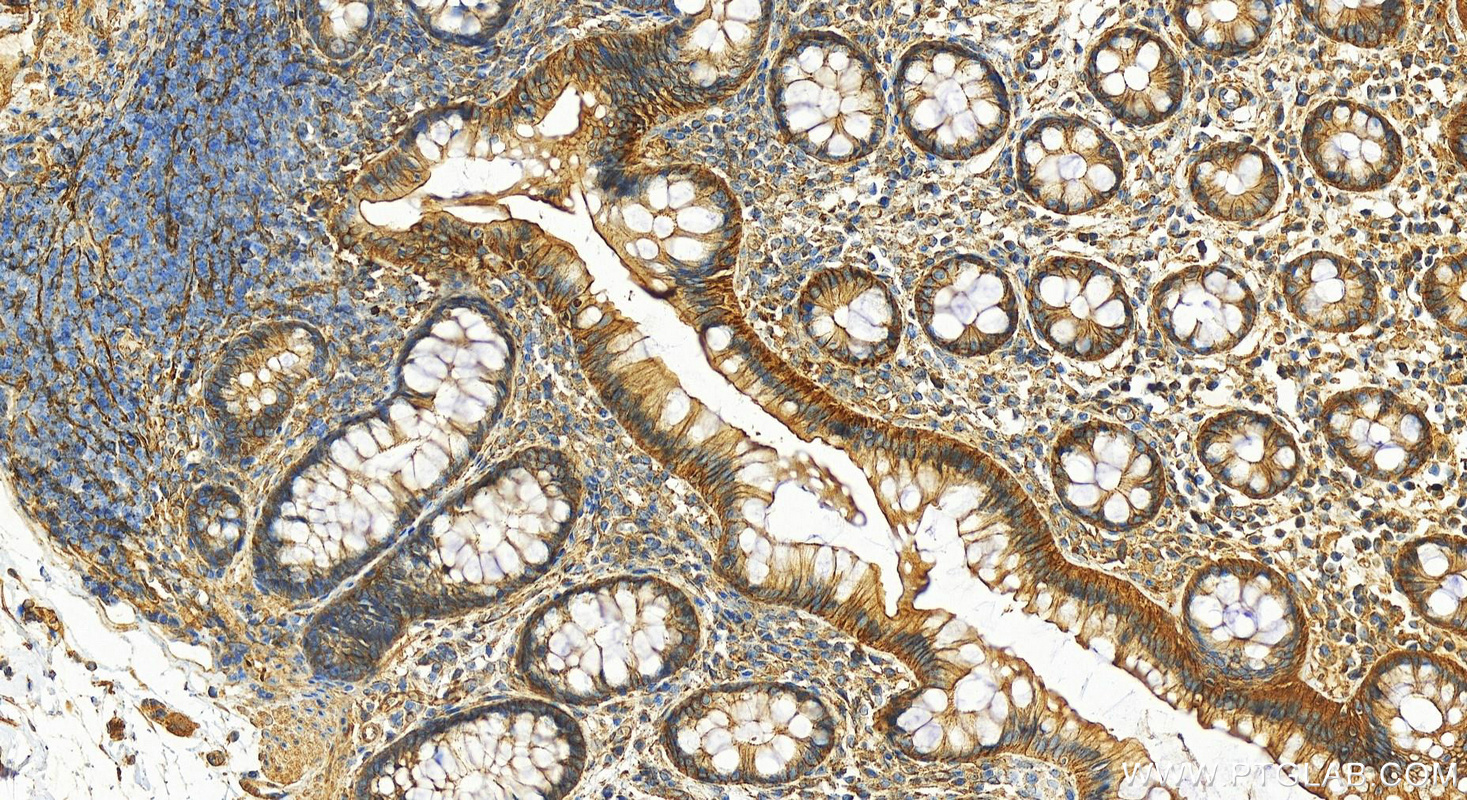 IHC staining of human normal colon using 28477-1-AP