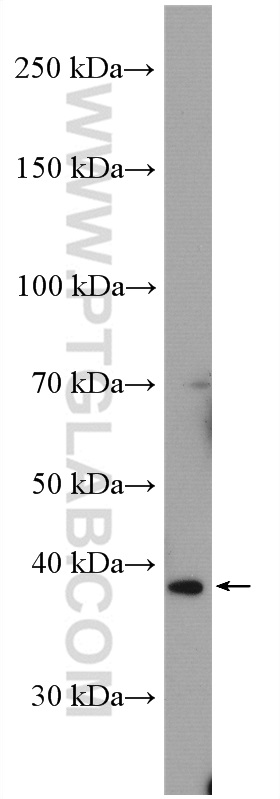 WB analysis of mouse heart using 55443-1-AP