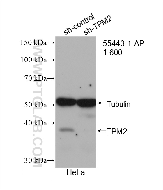 WB analysis of HeLa using 55443-1-AP