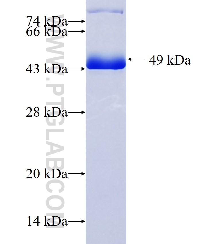 TPM2 fusion protein Ag17362 SDS-PAGE