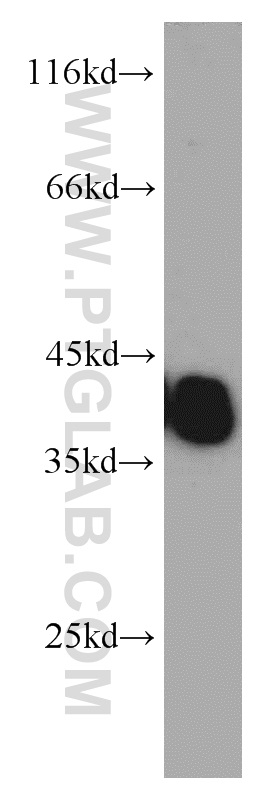 WB analysis of mouse skeletal muscle using 10737-1-AP