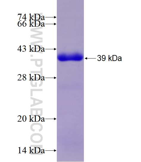 TPM3 fusion protein Ag28568 SDS-PAGE