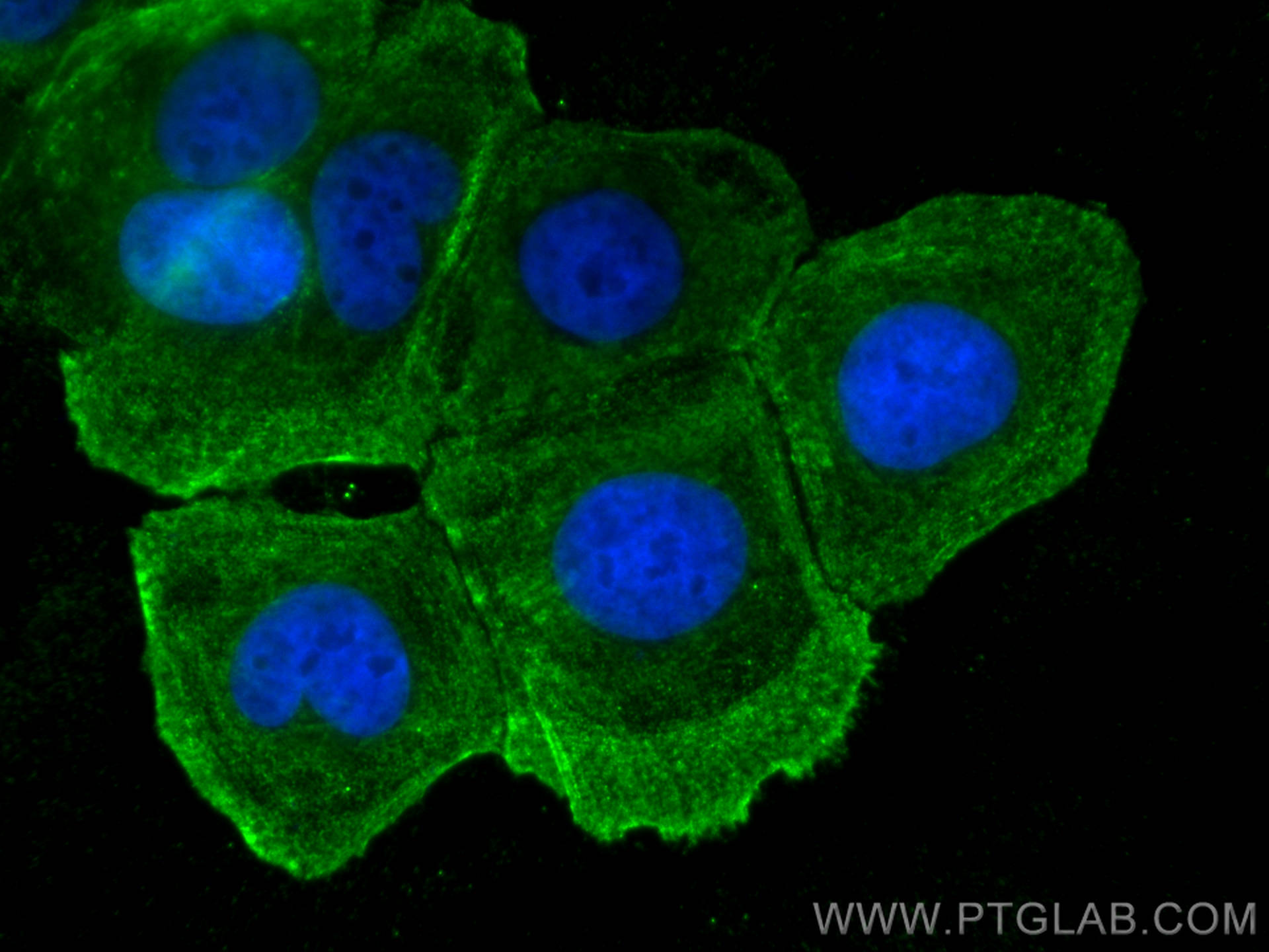 IF Staining of MCF-7 using 67244-1-Ig