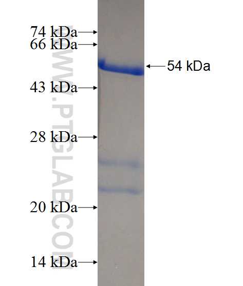 TPMT fusion protein Ag1074 SDS-PAGE