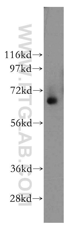 WB analysis of human colon using 12479-1-AP