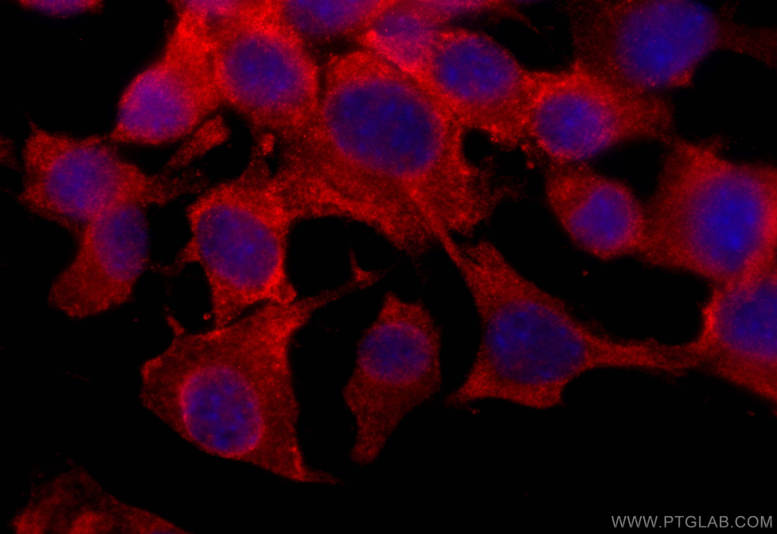 IF Staining of Neuro-2a using 18742-1-AP