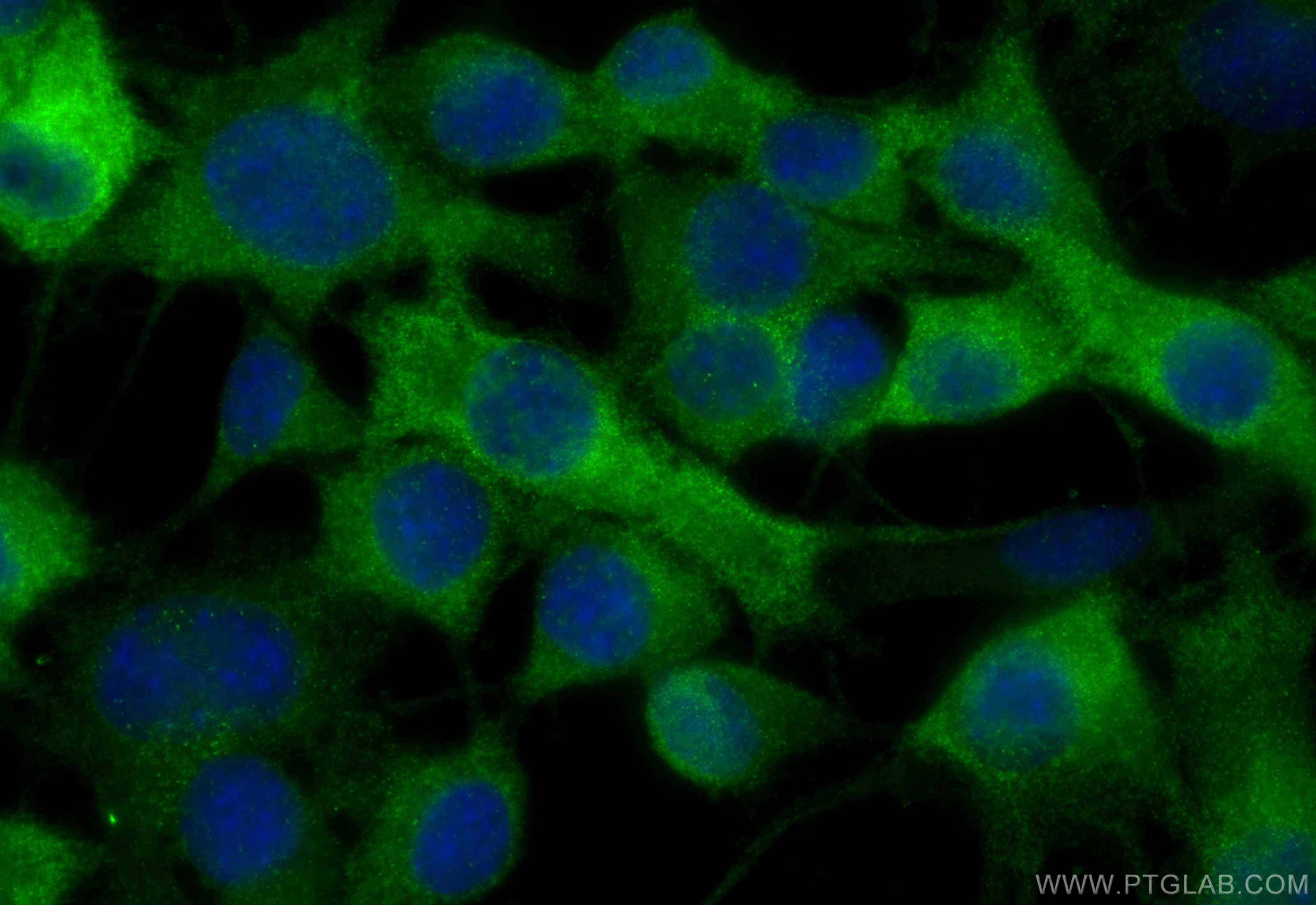 IF Staining of Neuro-2a using 68048-1-Ig