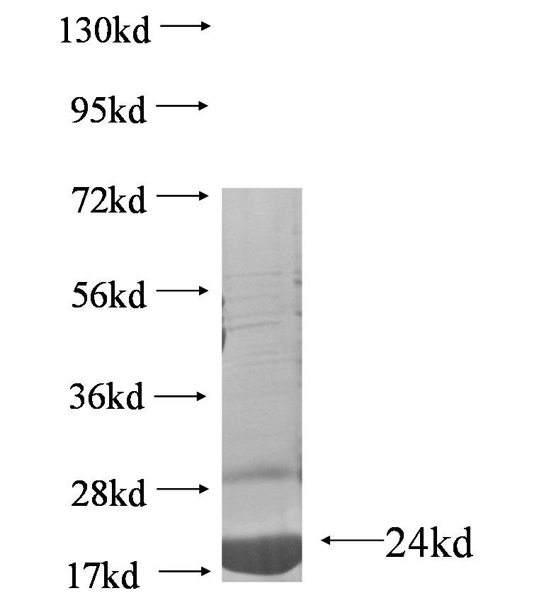 TPPP2 fusion protein Ag5324 SDS-PAGE