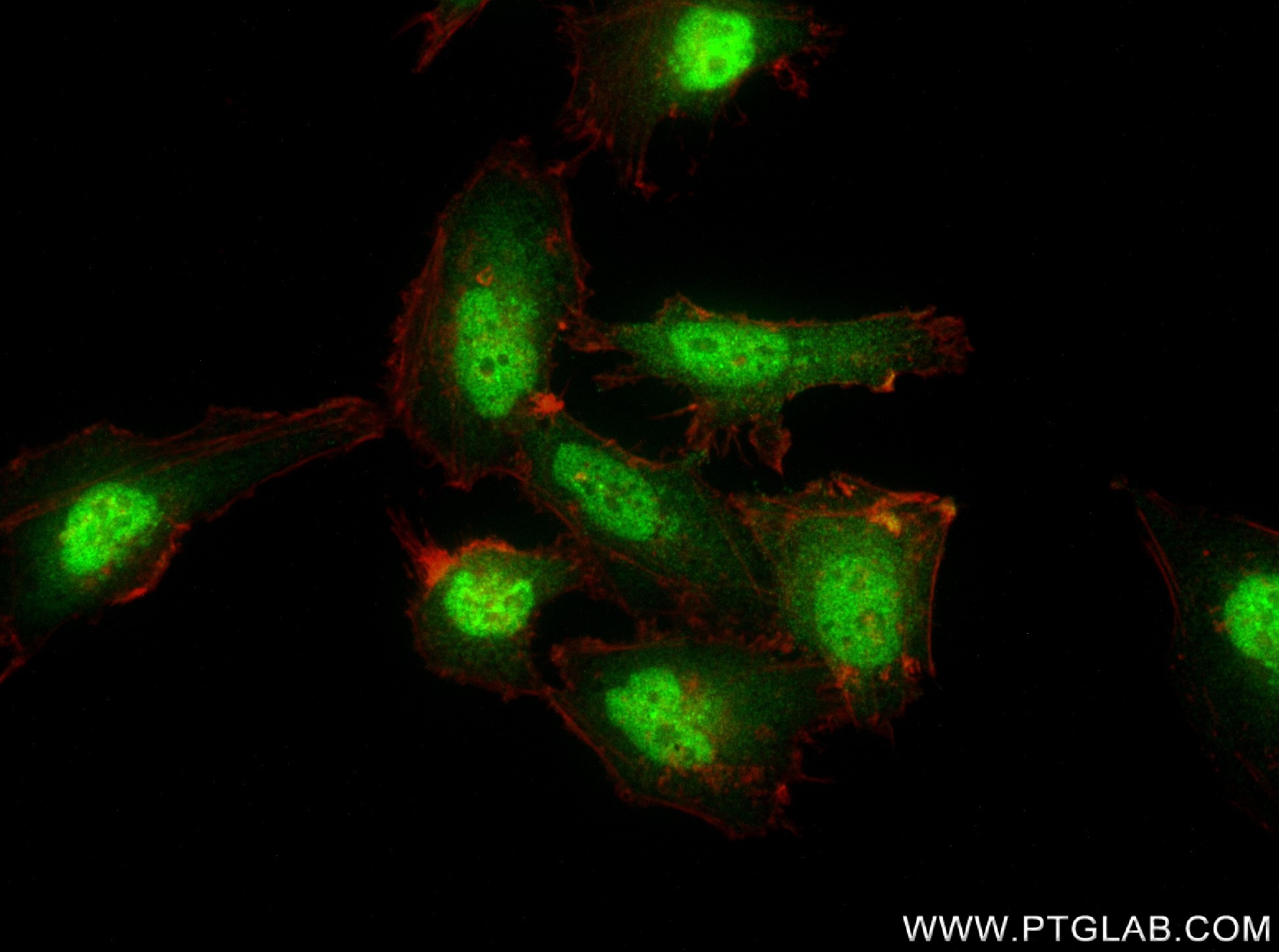 IF Staining of HeLa using 83177-5-RR (same clone as 83177-5-PBS)