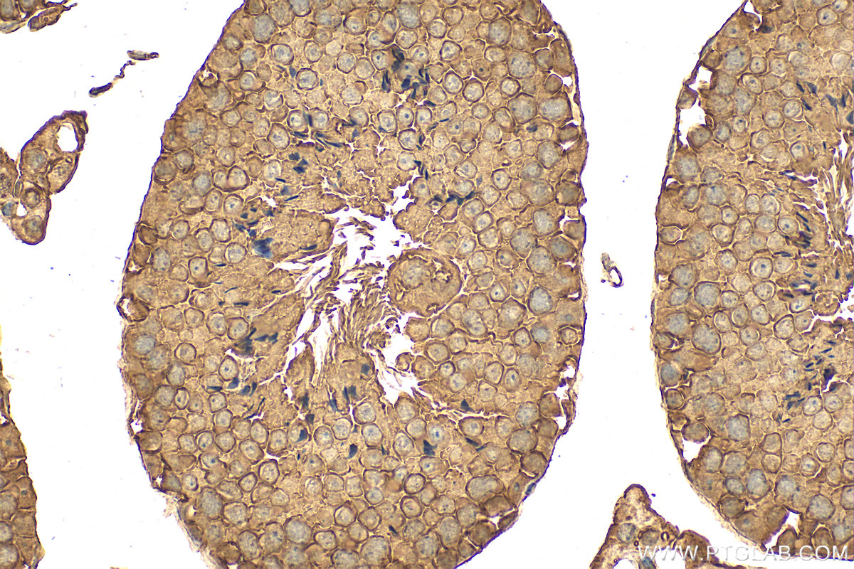 IHC staining of mouse testis using 83177-5-RR (same clone as 83177-5-PBS)