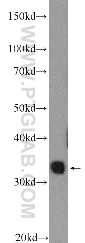 WB analysis of fetal human brain using 25834-1-AP