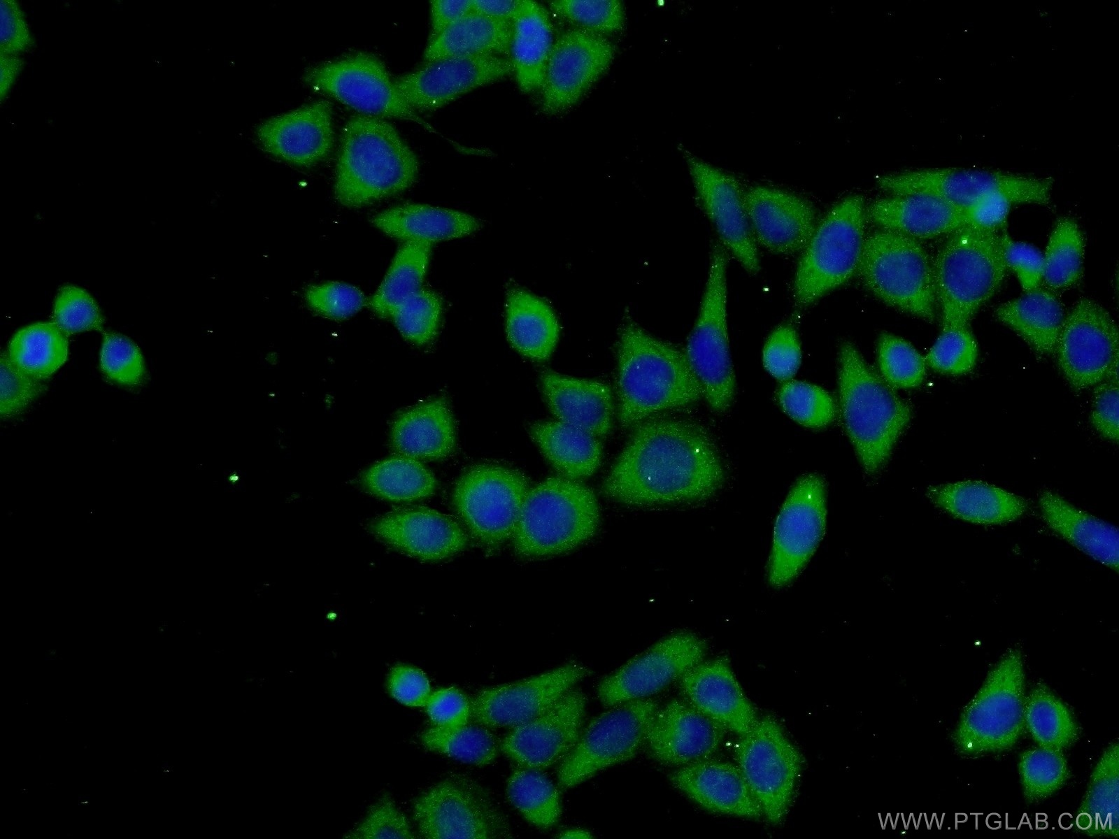 IF Staining of L02 using 25120-1-AP