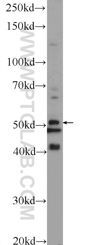 WB analysis of L02 using 25120-1-AP