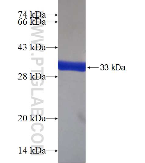 TPTE2 fusion protein Ag19169 SDS-PAGE