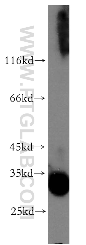 WB analysis of A549 using 12079-1-AP