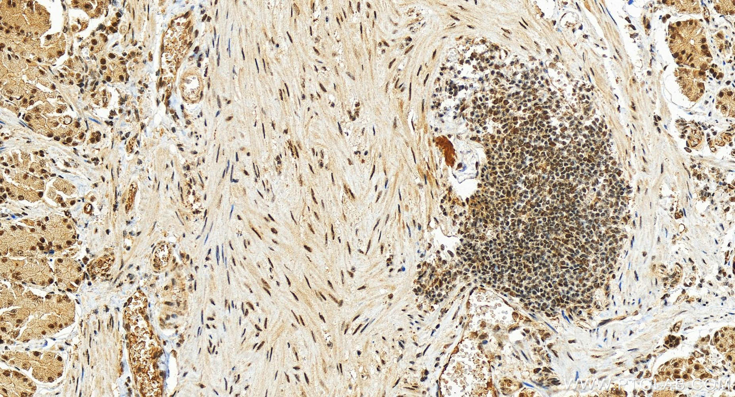 IHC staining of human stomach using 29627-1-AP