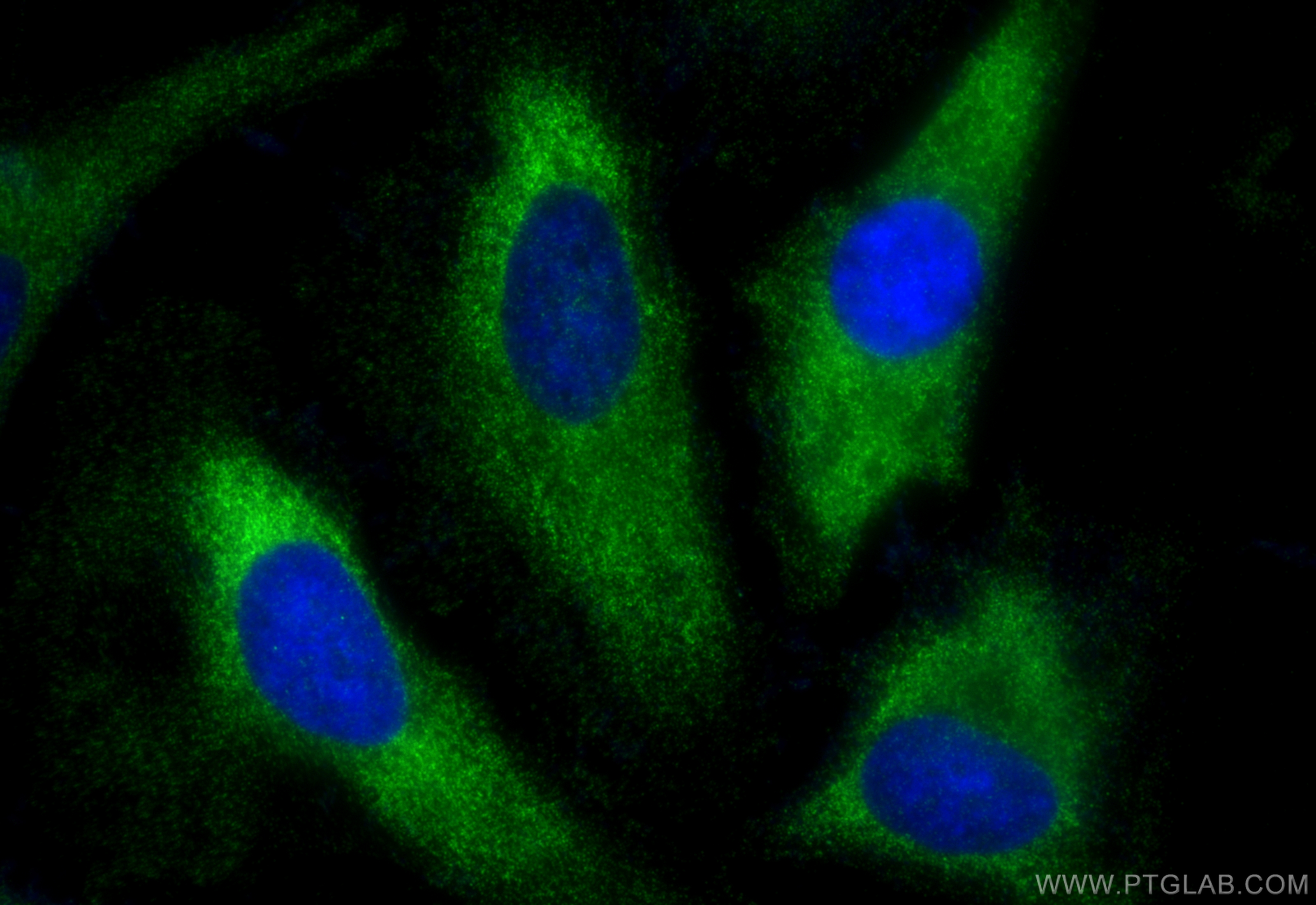 IF Staining of HeLa using 26846-1-AP