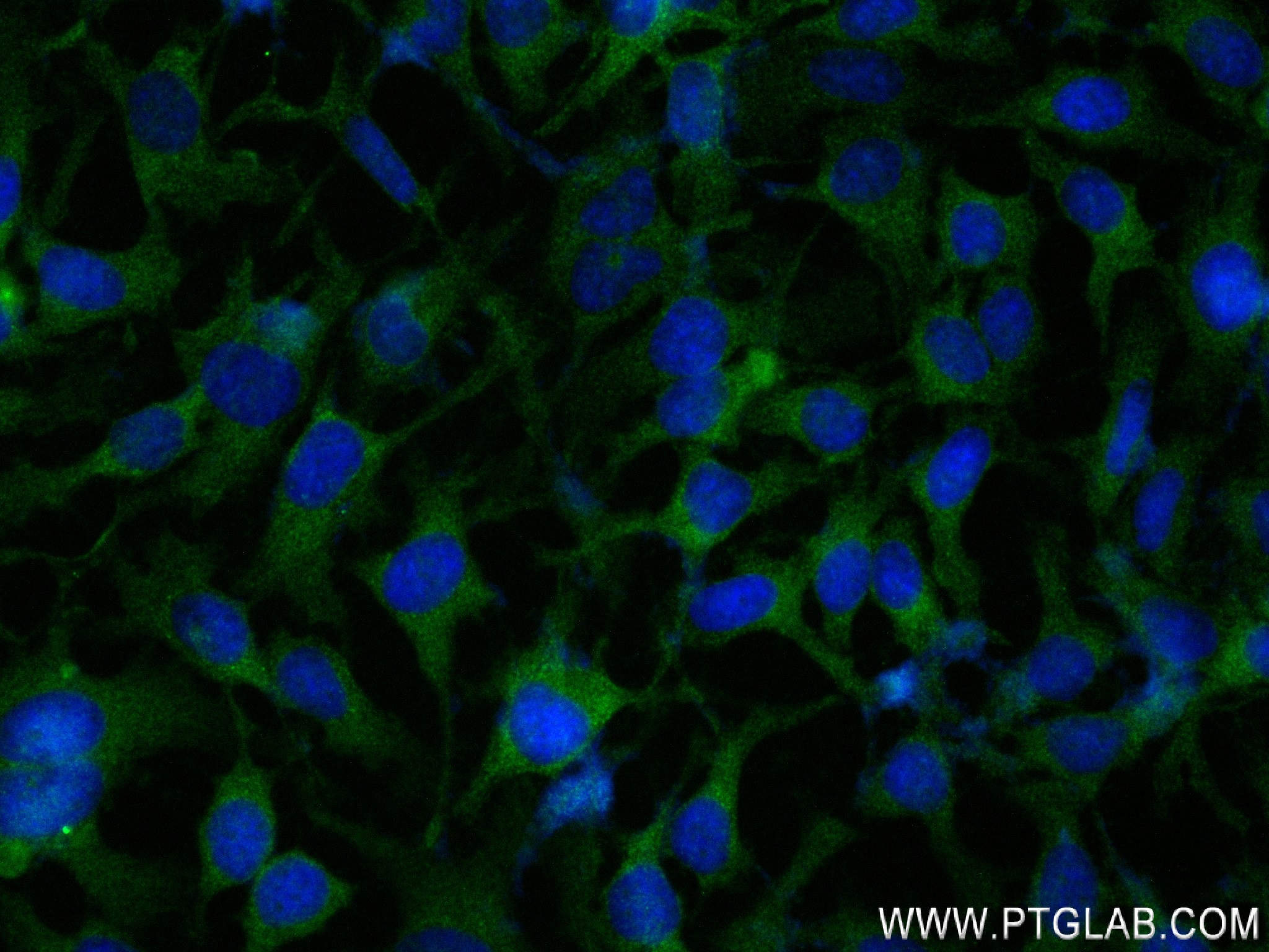 IF Staining of HeLa using 84581-3-RR (same clone as 84581-3-PBS)