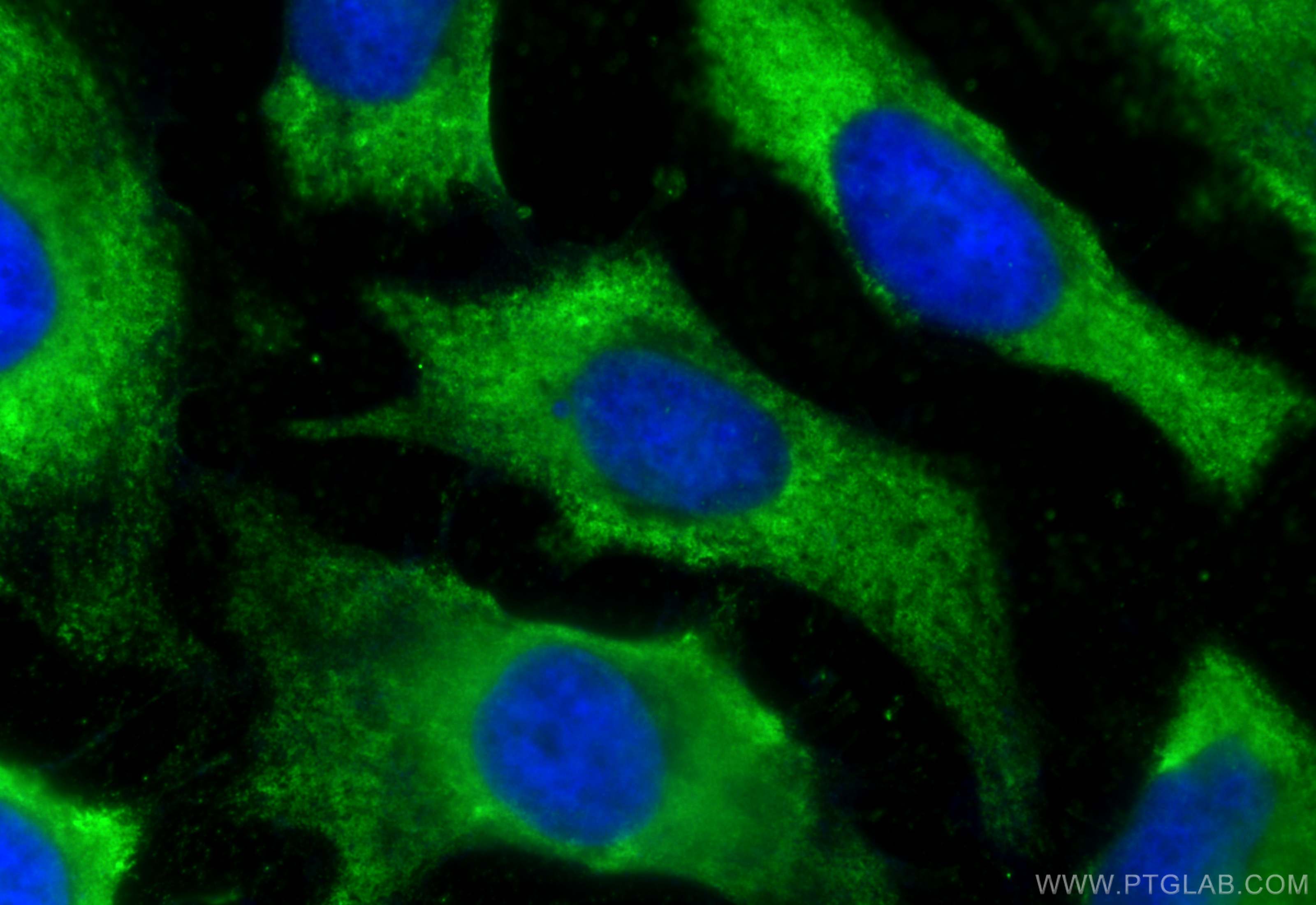 IF Staining of HeLa using CL488-67315