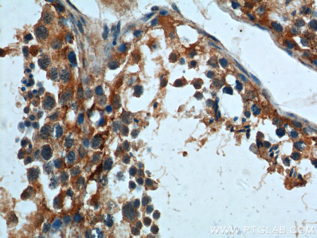 IHC staining of human testis using 10332-1-AP