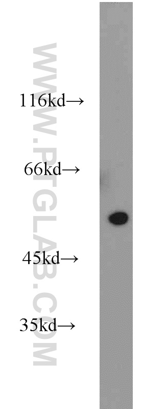 WB analysis of mouse brain using 10332-1-AP