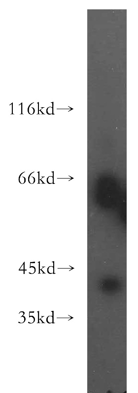 WB analysis of HepG2 using 13311-1-AP