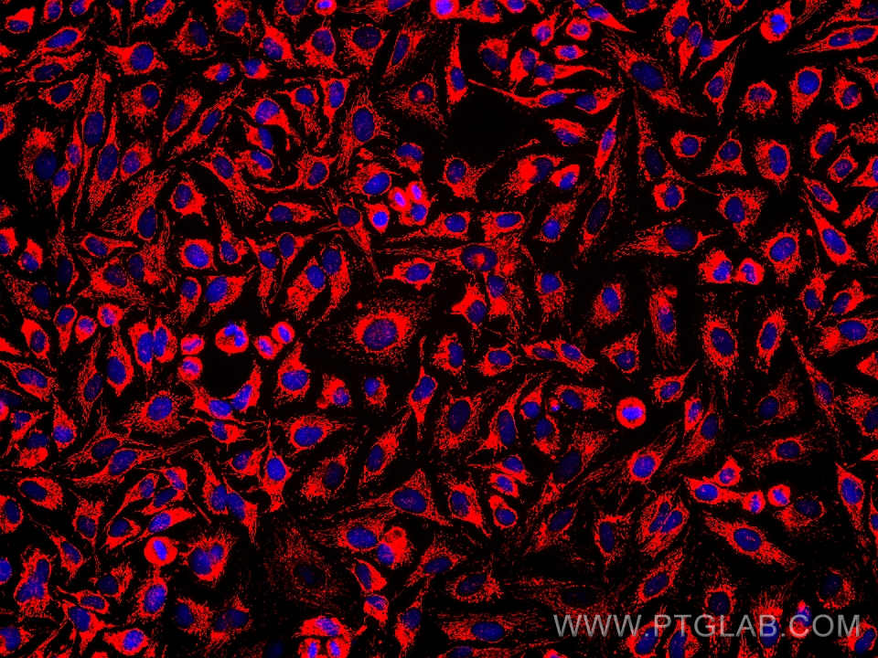 IF Staining of HeLa using 67693-1-Ig (same clone as 67693-1-PBS)