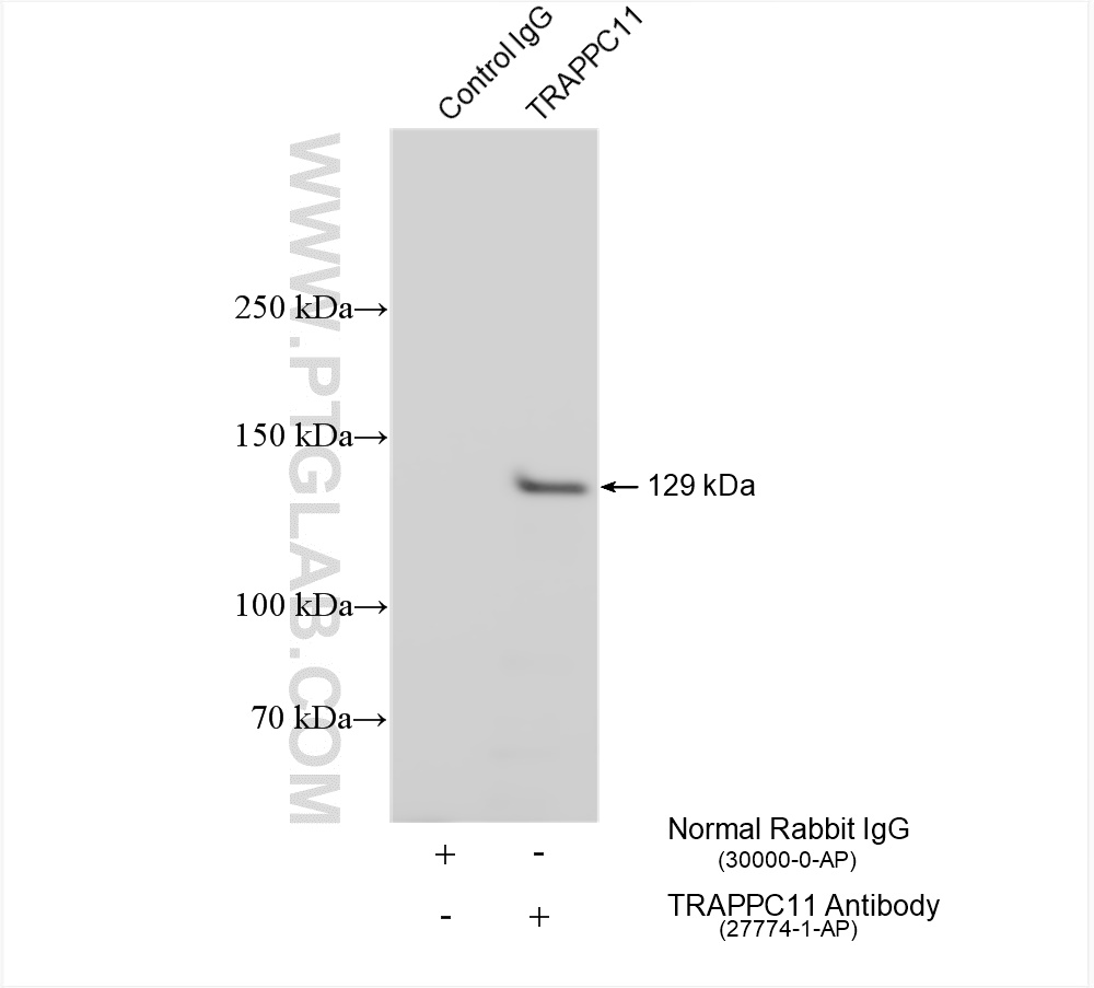 IP experiment of HeLa using 27774-1-AP