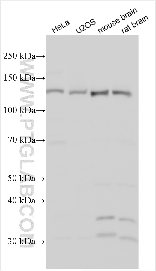 TRAPPC11