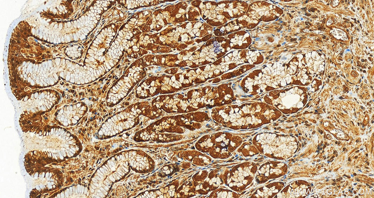 IHC staining of human stomach using 12484-1-AP