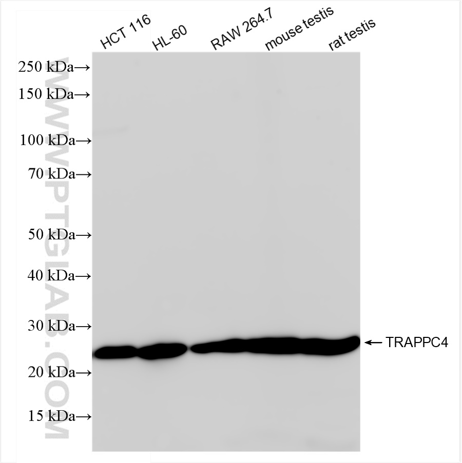 WB analysis using 84119-3-RR (same clone as 84119-3-PBS)