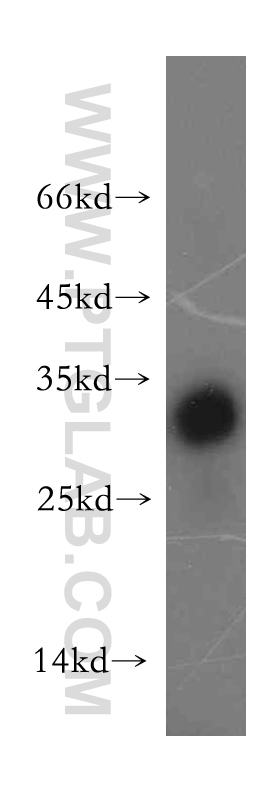 WB analysis of mouse thymus using 13279-1-AP