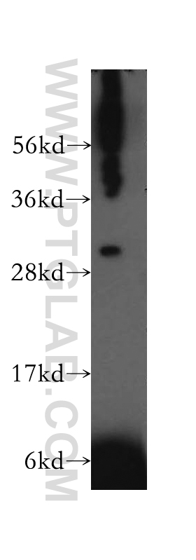 WB analysis of K-562 using 13132-1-AP