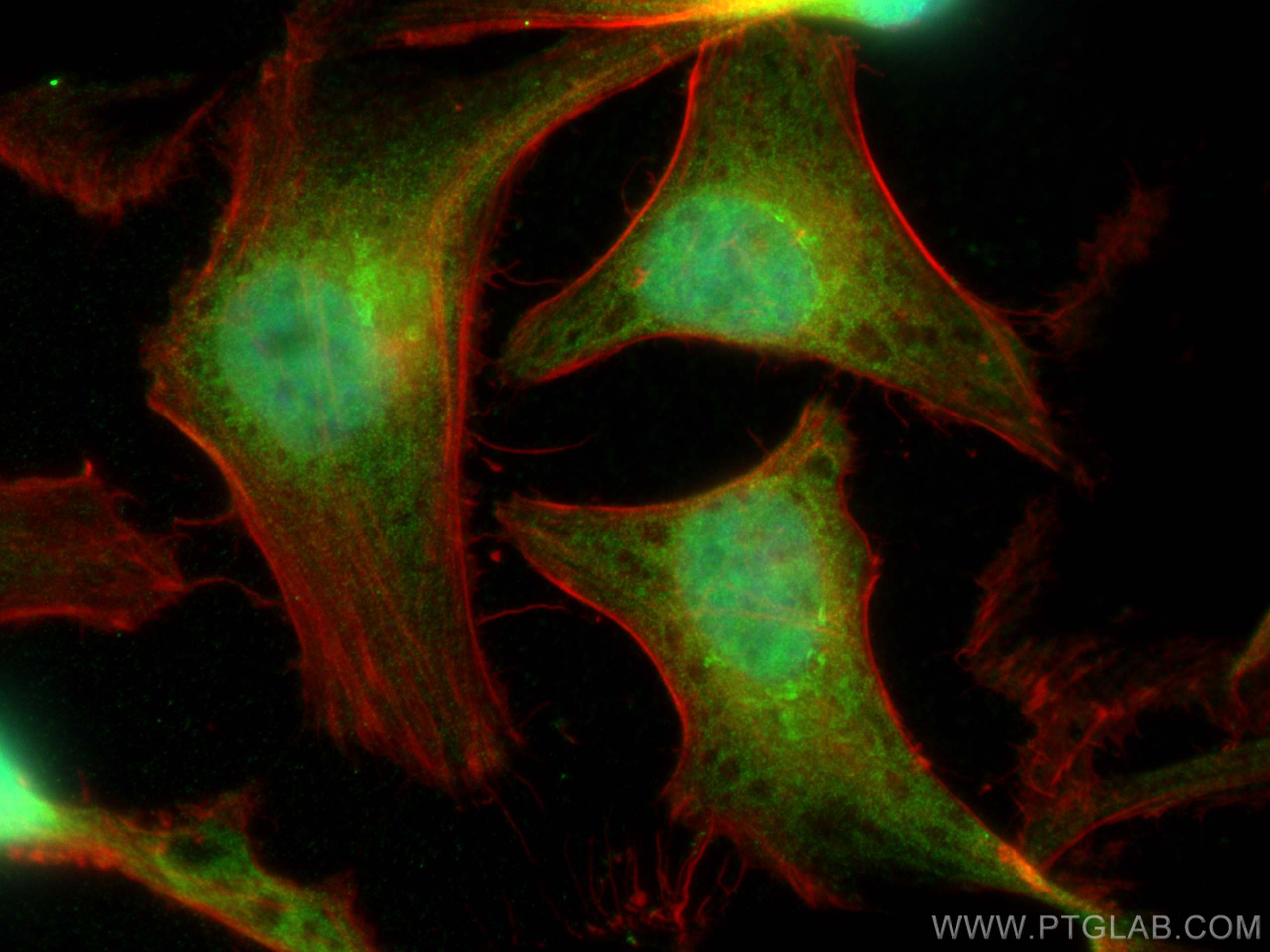 IF Staining of HeLa using 15753-1-AP