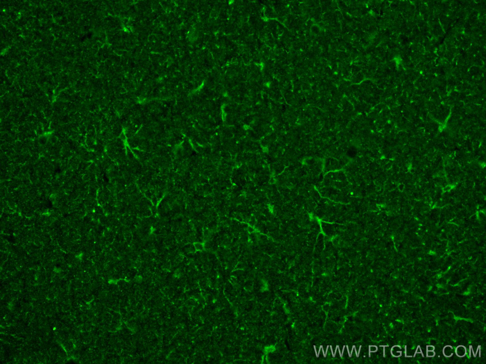 IF Staining of rat brain using 68723-1-Ig