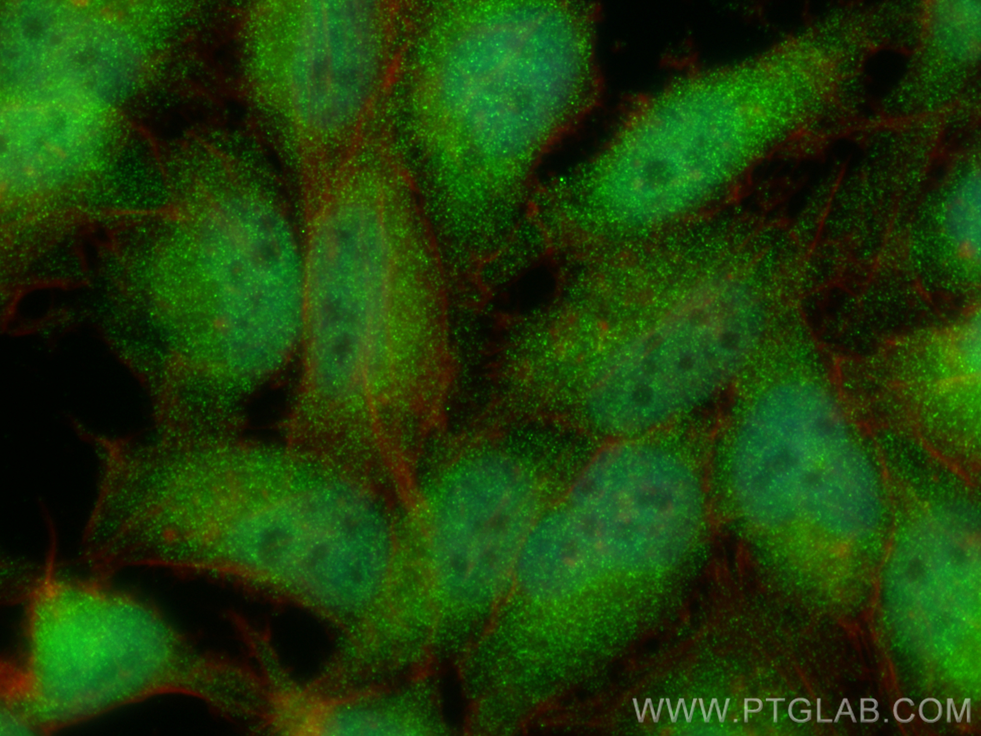 IF Staining of HeLa using 24876-1-AP