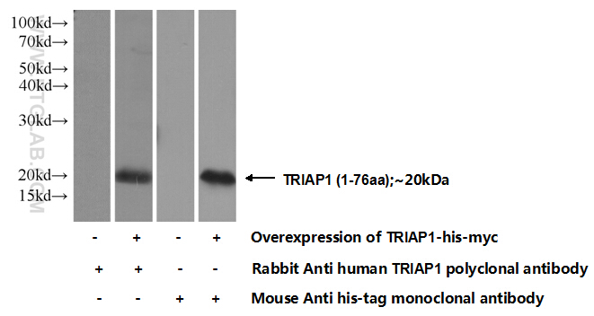 TRIAP1