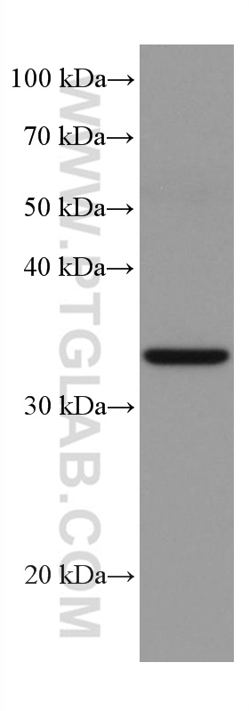 WB analysis of A549 using 67171-1-Ig