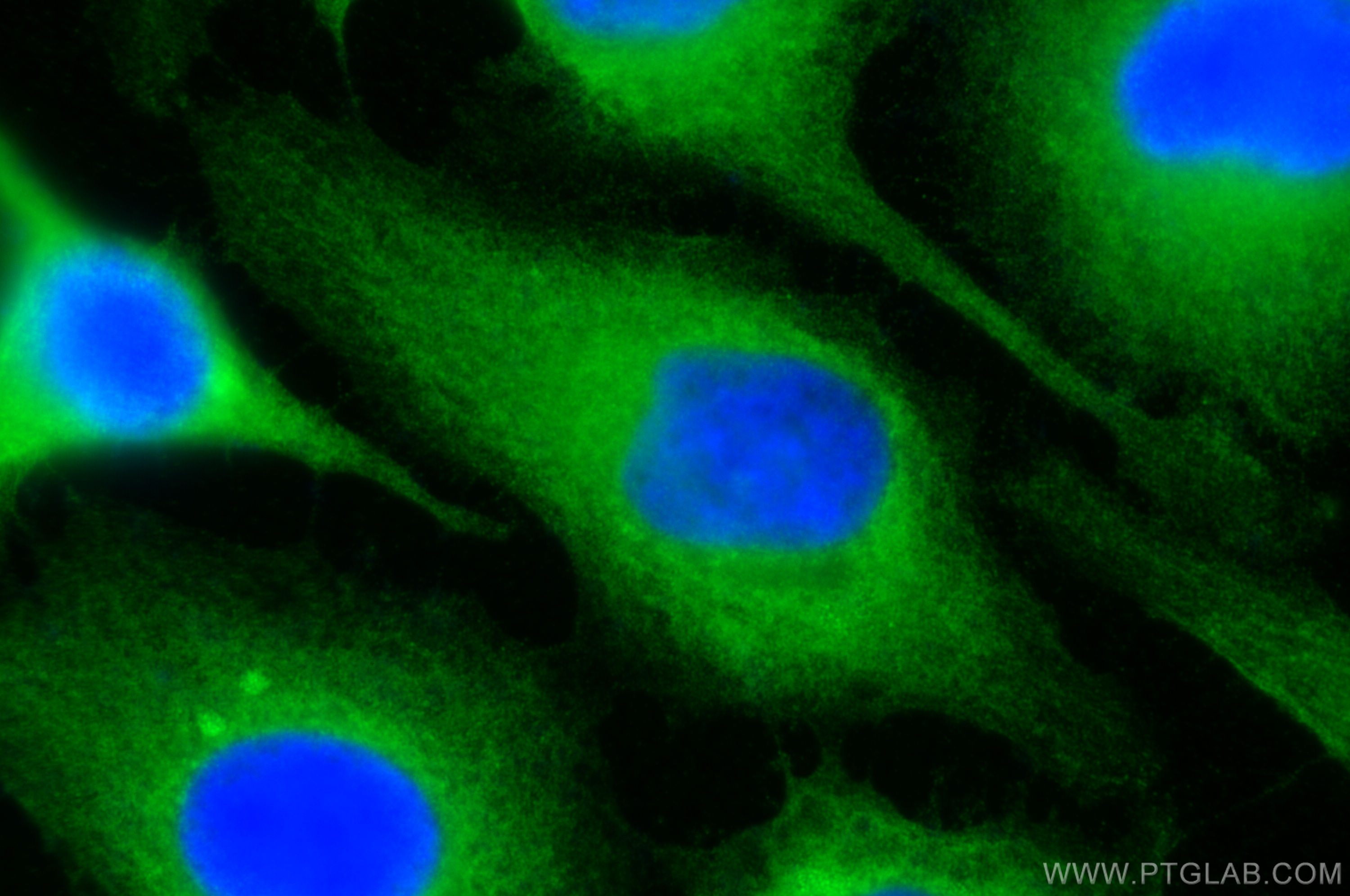 IF Staining of HeLa using 15742-1-AP