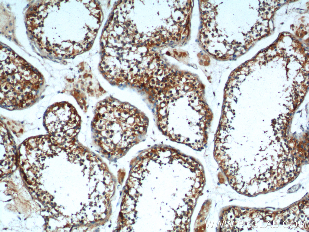 IHC staining of human testis using 24403-1-AP