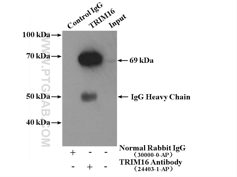 IP experiment of HeLa using 24403-1-AP