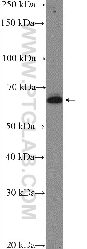 WB analysis of HepG2 using 24403-1-AP