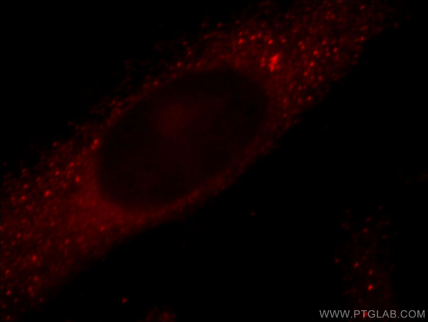 IF Staining of HeLa using 20356-1-AP