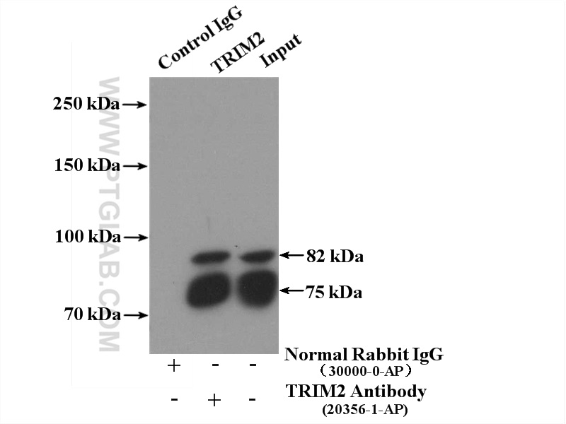 IP experiment of mouse brain using 20356-1-AP