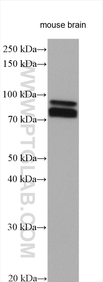 WB analysis using 20356-1-AP