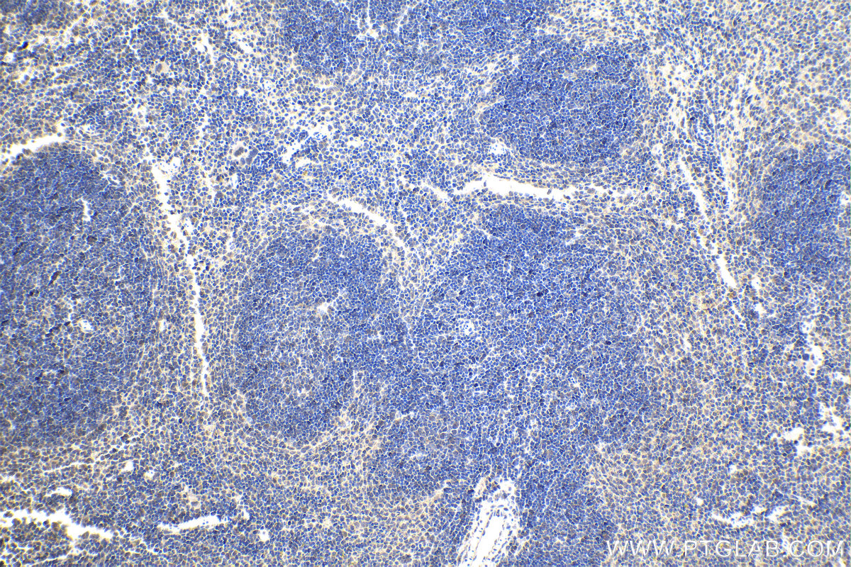 IHC staining of mouse spleen using 13744-1-AP