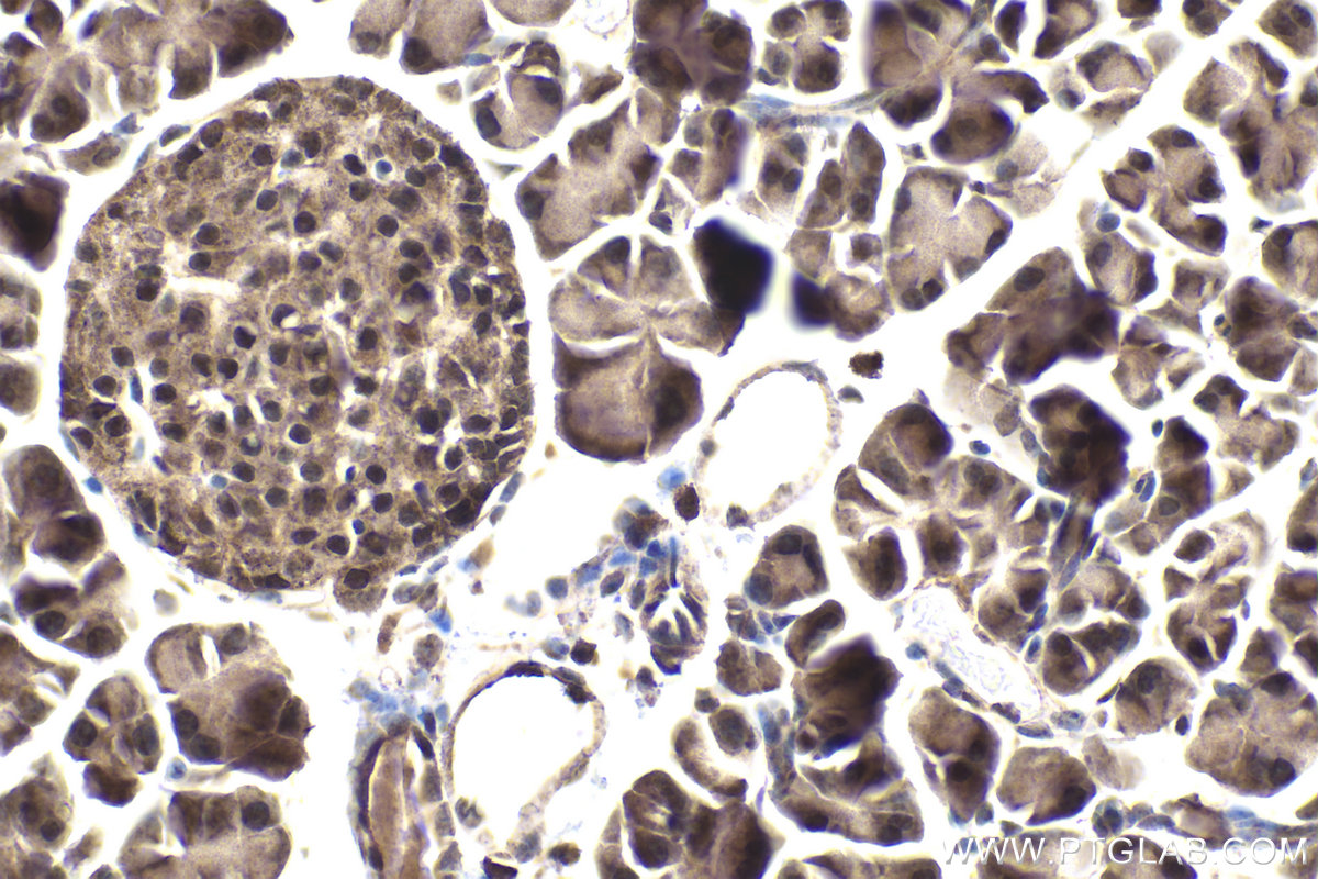 IHC staining of mouse pancreas using 13744-1-AP
